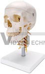 Human Skull on Cervical Spine - 4 part